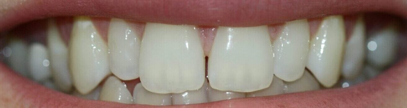 Megan Before ,