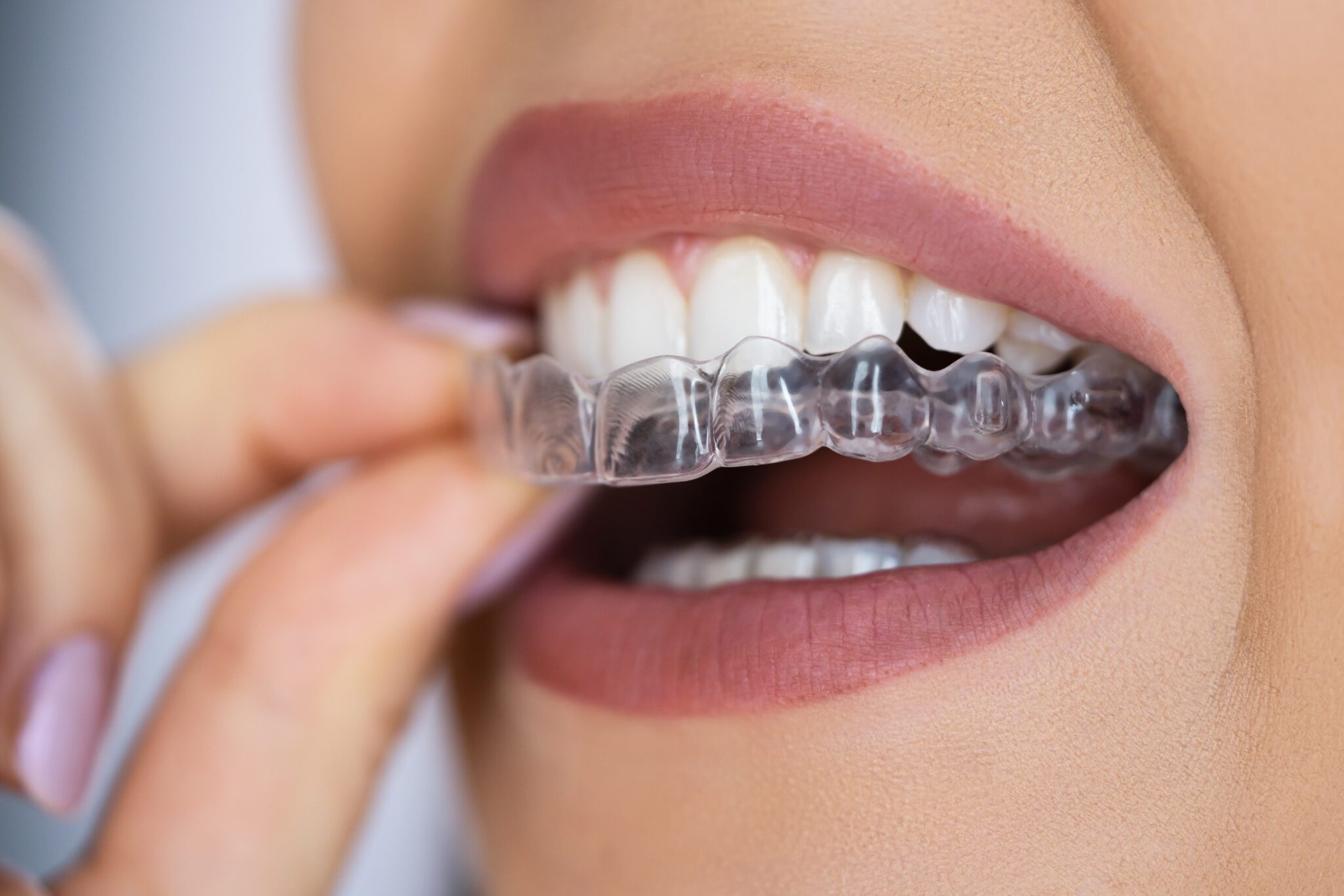 dentist near me, cosmetic dentist, dental clinic Sacramento